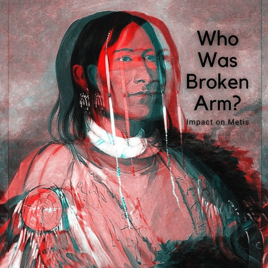 Who was broken arm
